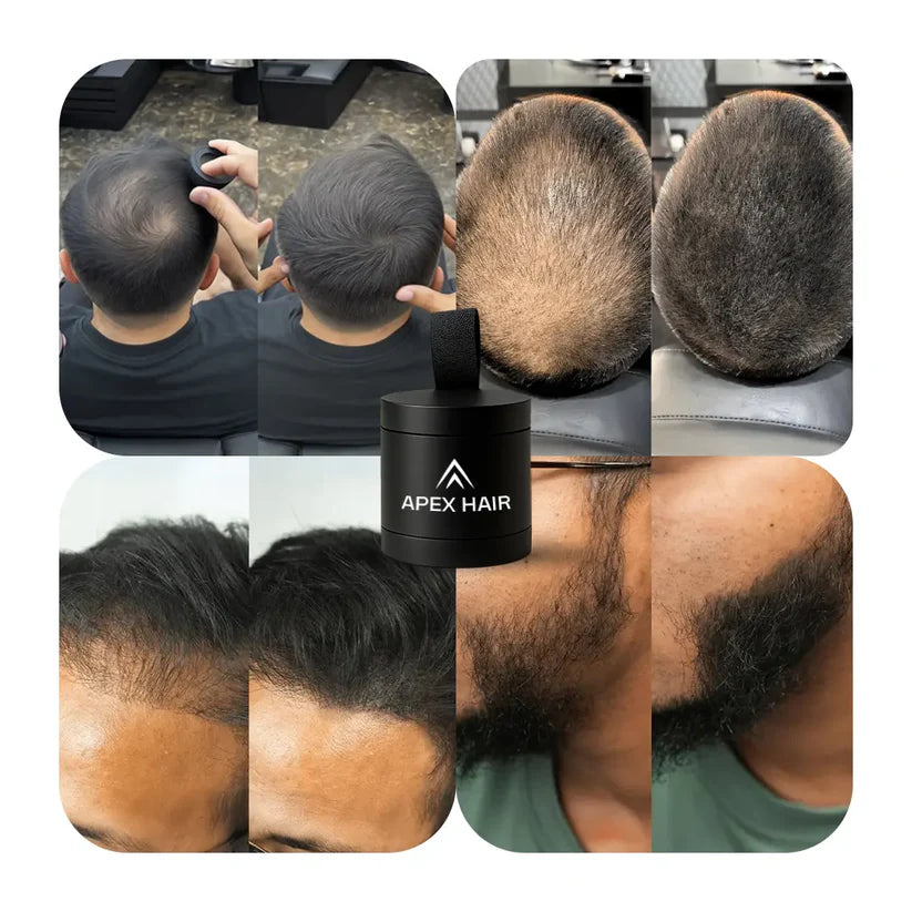 Apex Hair® – Camuflaje Capilar Profesional – Fijación resistente al agua y al sudor por hasta 48 horas.