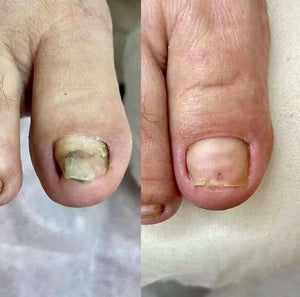 DIGA ADIÓS A LOS TRATAMIENTOS INEFICACES Y CONSIGA UNAS UÑASPERFECTAS EN SÓLO 3 SEMANAS